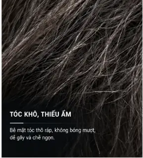Tóc chẻ ngọn xơ rối và hư tổn ở nam giới