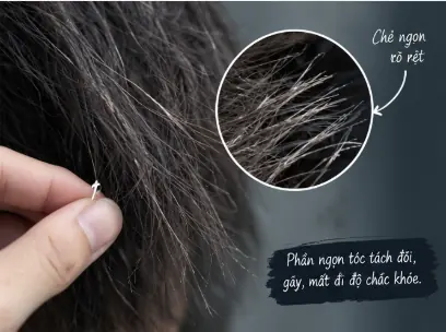 Tóc chẻ ngọn xơ rối và hư tổn ở nam giới