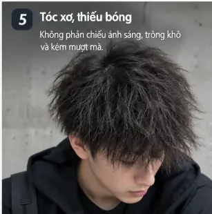 toc-kho-xo-nam