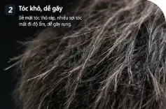 toc-kho-xo-nam